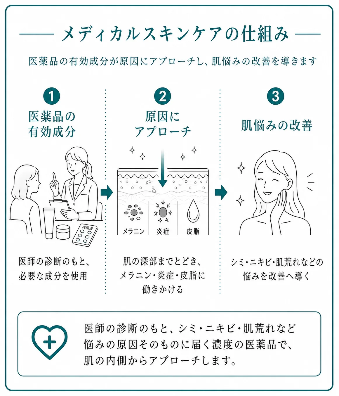 仕組み